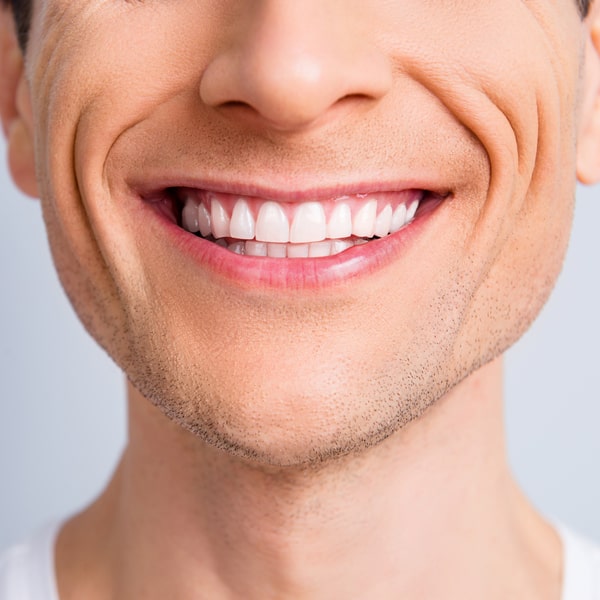 Natural looking restored front teeth with a perfect smile
